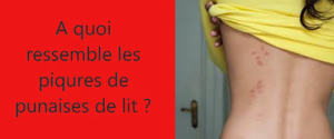a quoi ressemble les piqure de punaises de lit